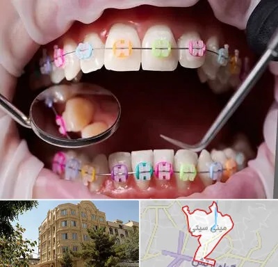 متخصص ارتودنسی در مینی سیتی