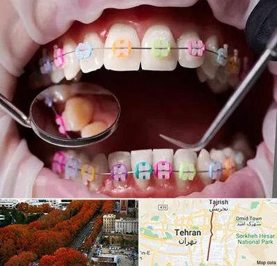 متخصص ارتودنسی در ولیعصر 