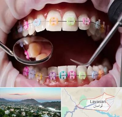 متخصص ارتودنسی در لواسان