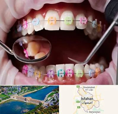 متخصص ارتودنسی در اصفهان
