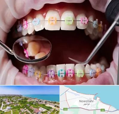 متخصص ارتودنسی در نوشهر