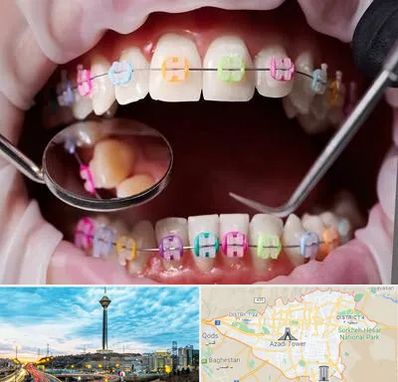 متخصص ارتودنسی در تهران