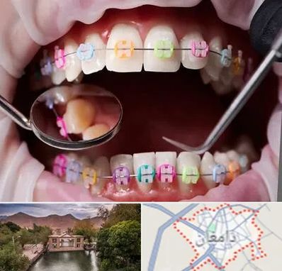 متخصص ارتودنسی در دامغان