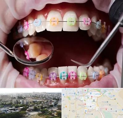 متخصص ارتودنسی در منطقه 20 تهران