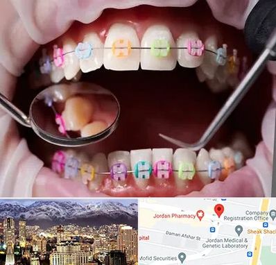 متخصص ارتودنسی در جردن 