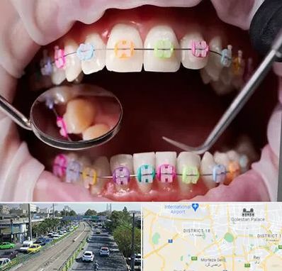 متخصص ارتودنسی در جنوب تهران 