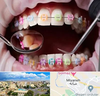 متخصص ارتودنسی در میانه