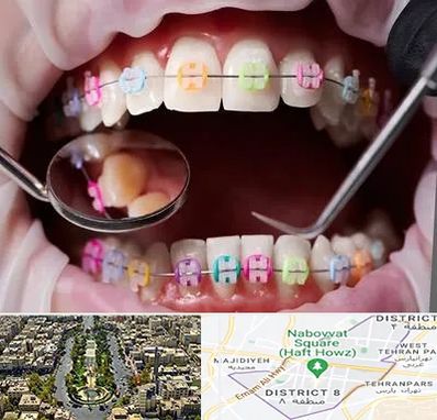 متخصص ارتودنسی در نارمک 