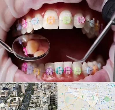 متخصص ارتودنسی در منطقه 18 تهران