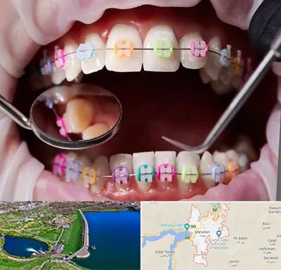 متخصص ارتودنسی در مهاباد