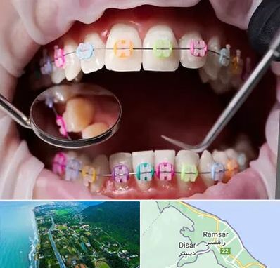 متخصص ارتودنسی در رامسر