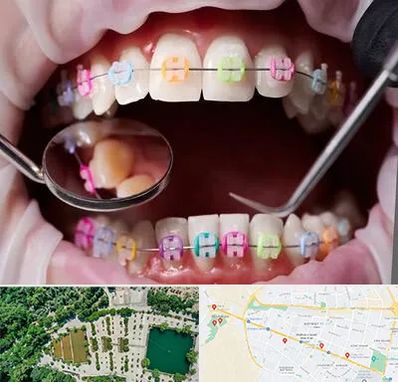 متخصص ارتودنسی در وکیل آباد مشهد