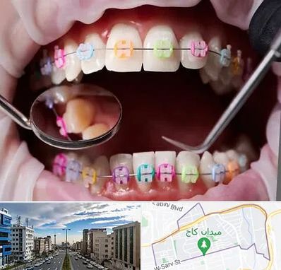 متخصص ارتودنسی در سعادت آباد 