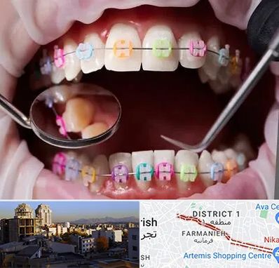 متخصص ارتودنسی در فرمانیه 