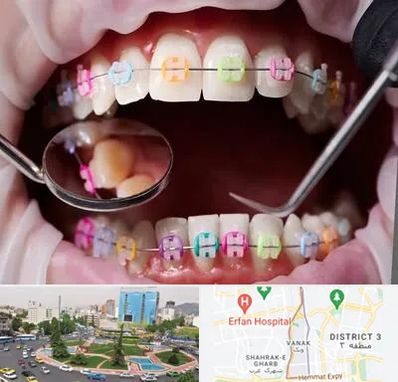 متخصص ارتودنسی در ونک 