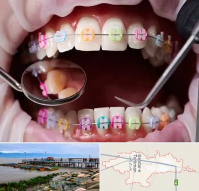 متخصص ارتودنسی در بندر ترکمن