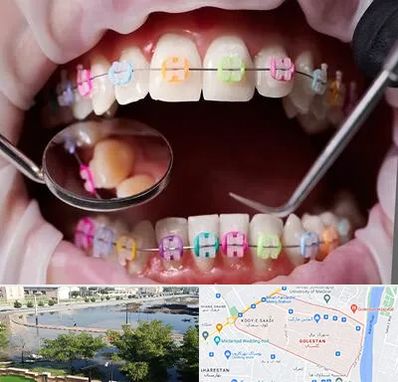 متخصص ارتودنسی در گلستان اهواز