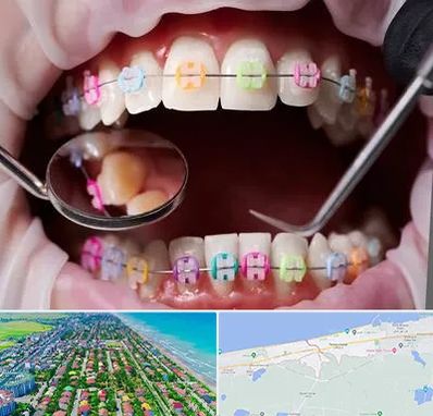 متخصص ارتودنسی در فریدونکنار