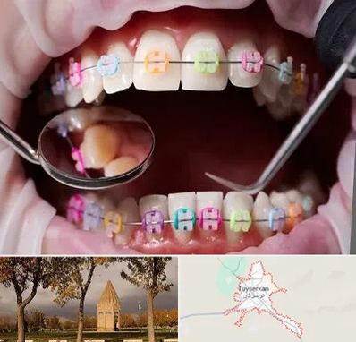 متخصص ارتودنسی در تویسرکان