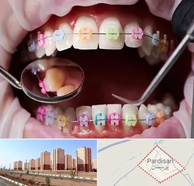 متخصص ارتودنسی در پردیسان قم