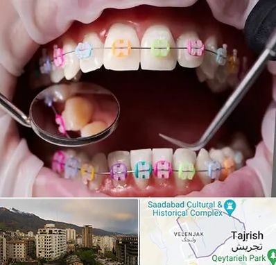 متخصص ارتودنسی در زعفرانیه 