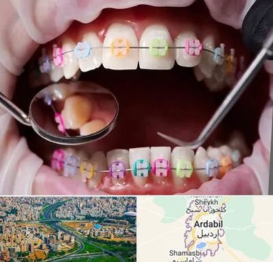 متخصص ارتودنسی در اردبیل