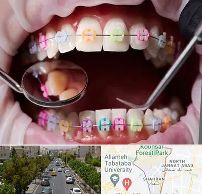 متخصص ارتودنسی در شهران 