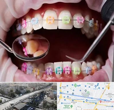 متخصص ارتودنسی در فرجام