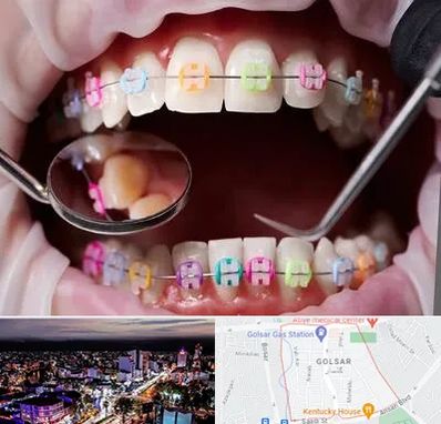 متخصص ارتودنسی در گلسار رشت 