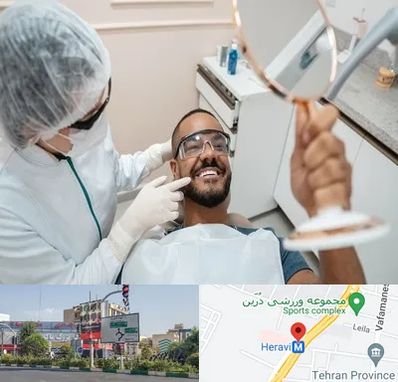 ایمپلنت فوری در هروی 