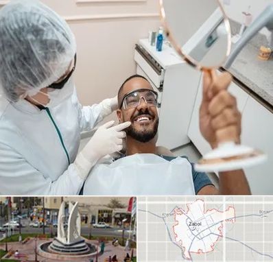 ایمپلنت فوری در زابل