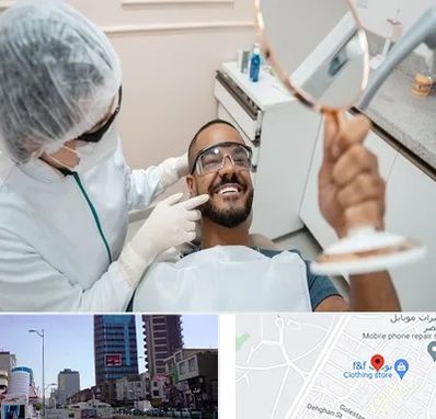 ایمپلنت فوری در چهارراه طالقانی کرج