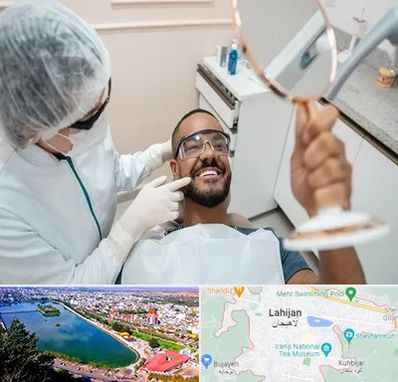 ایمپلنت فوری در لاهیجان