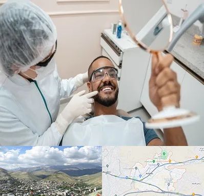 ایمپلنت فوری در رودهن