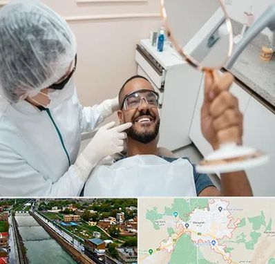 ایمپلنت فوری در مراغه