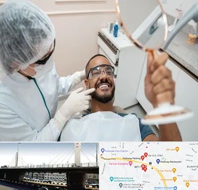 ایمپلنت فوری در پارک وی 