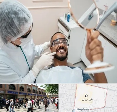 ایمپلنت فوری در بازار تهران