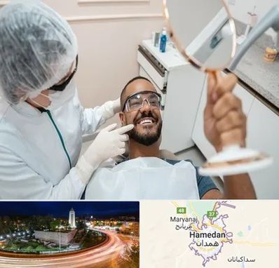 ایمپلنت فوری در همدان