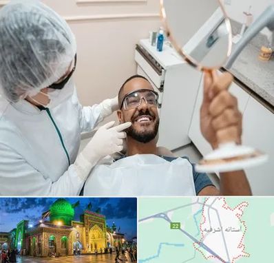 ایمپلنت فوری در آستانه اشرفیه