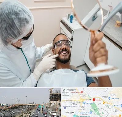 ایمپلنت فوری در بلوار توس مشهد