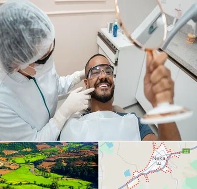 ایمپلنت فوری در نکا
