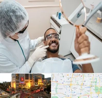 ایمپلنت فوری در جنت آباد تهران 