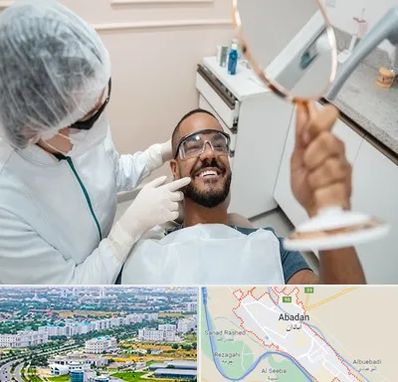 ایمپلنت فوری در آبادان