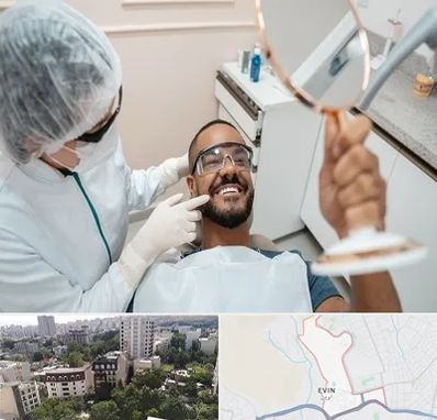 ایمپلنت فوری در اوین