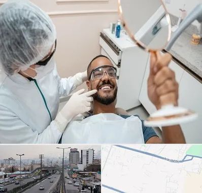 ایمپلنت فوری در بلوار ارتش