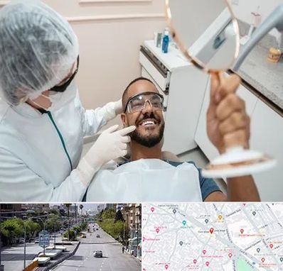 ایمپلنت فوری در خیابان زند شیراز