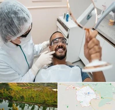 ایمپلنت فوری در بهبهان