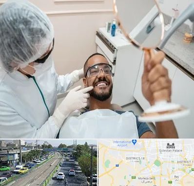 ایمپلنت فوری در جنوب تهران 