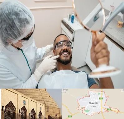 ایمپلنت فوری در ساوه