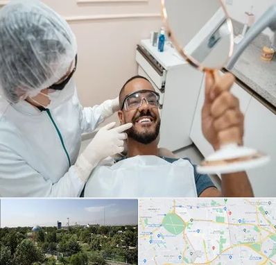 ایمپلنت فوری در منطقه 16 تهران